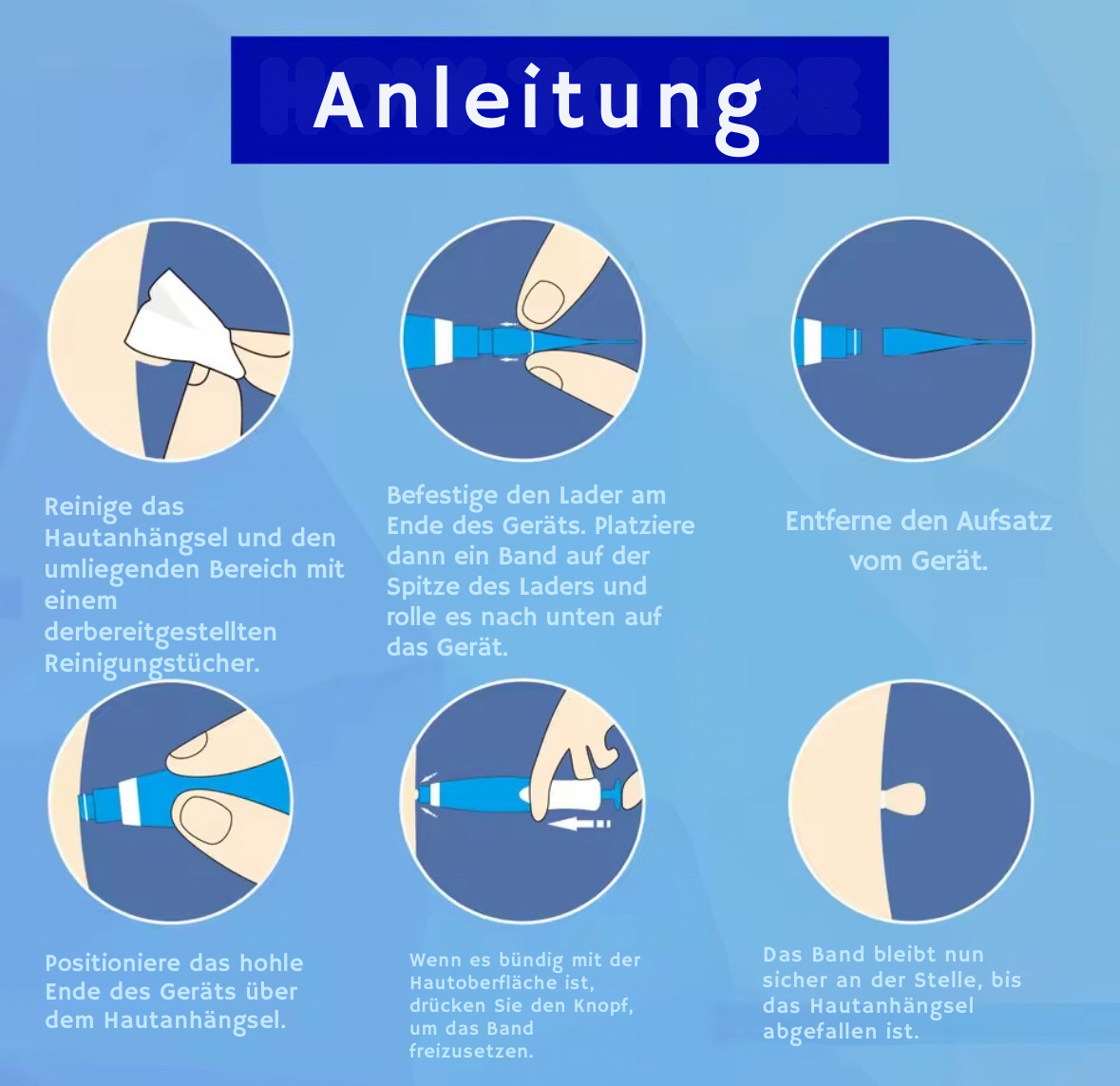 Nie wieder Hautanhängsel