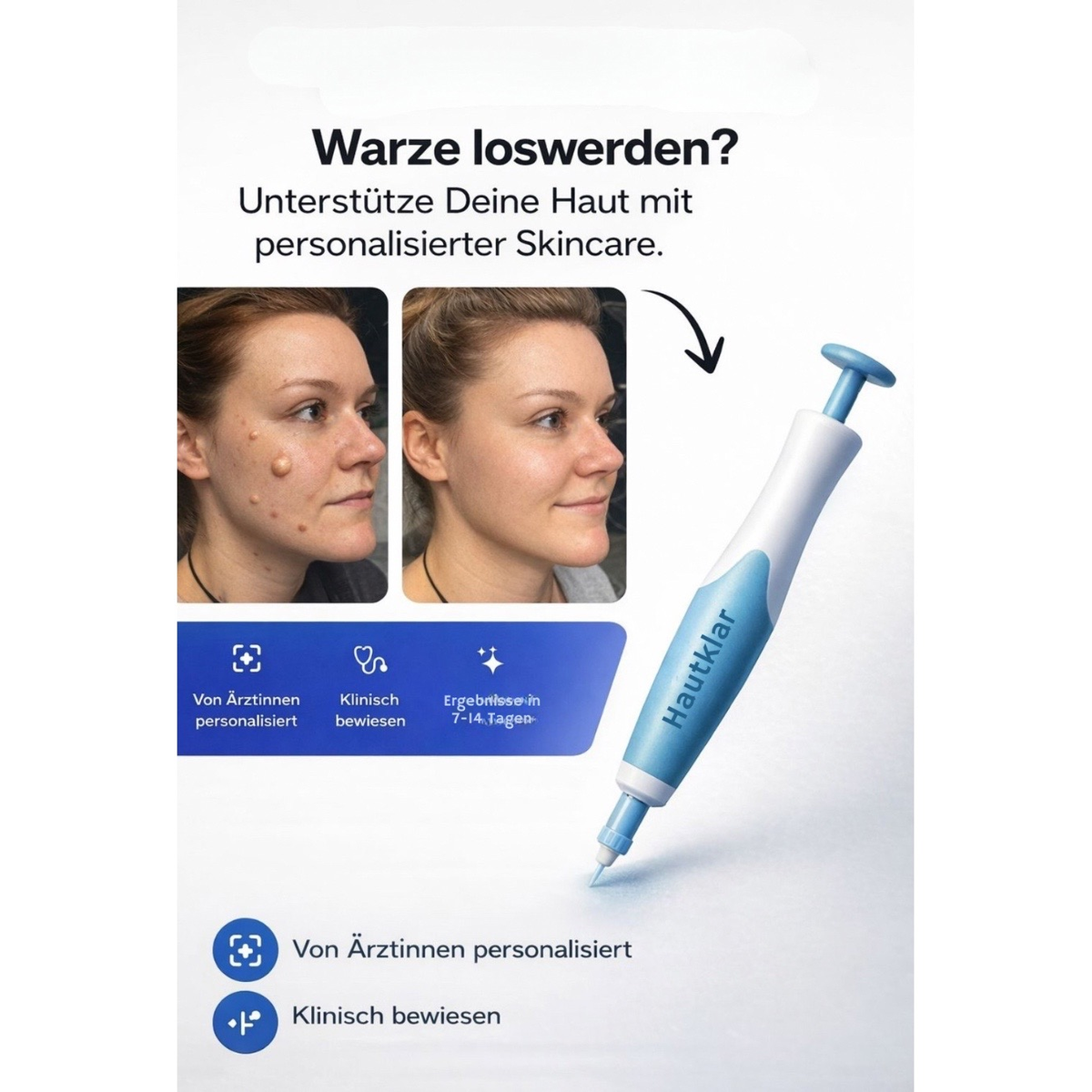 Nie wieder Hautanhängsel