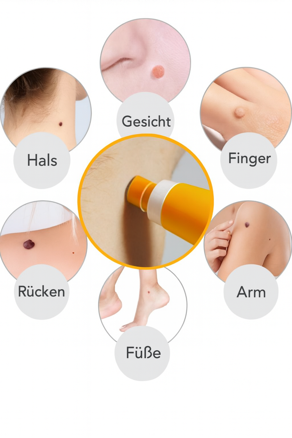 Nie wieder Hautanhängsel