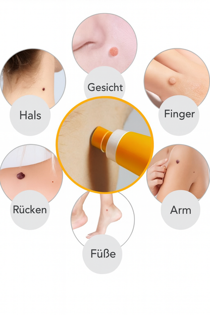 Nie wieder Hautanhängsel